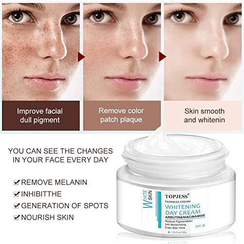 Whitening-Creme TOPJESS Freckle Brightening Cream