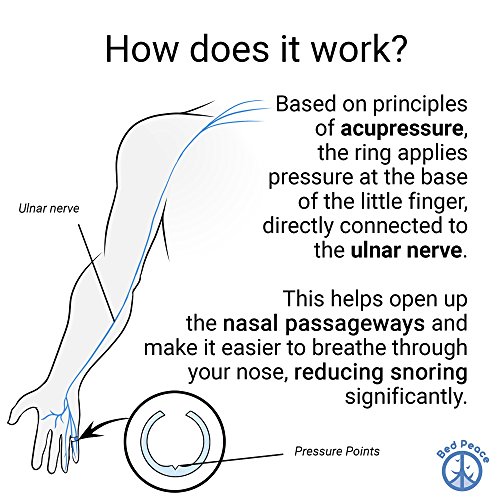 Anti-Schnarchring Bedpeace Anti-schnarch Ring, diskrete Lösung