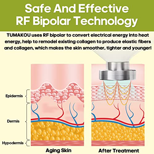 Mikrodermabrasion-Gerät TUMAKOU RF Radio Frequenz Gerät