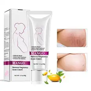 Dehnungsstreifen creme duvina stretch marks cream narbencreme