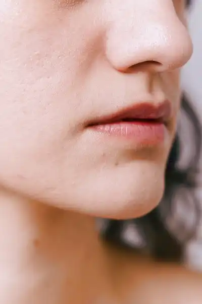Cream against pimples