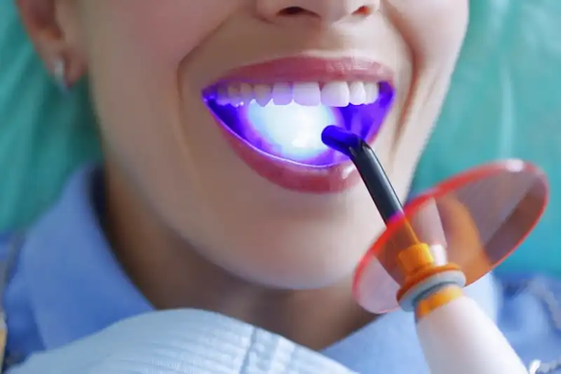 Aktivkohle für die Zähne_1