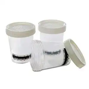 Urinbecher healway steriler probenbecher schraubverschluss