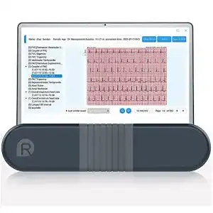 Mobiles EKG-Gerät Wellue ER1 Monitor für 24-Stunden Herzüberwachung