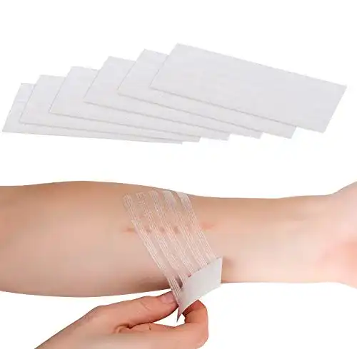 Klammerpflaster Newgen Medicals 30er-Pack medizinische Wundnahtstreifen