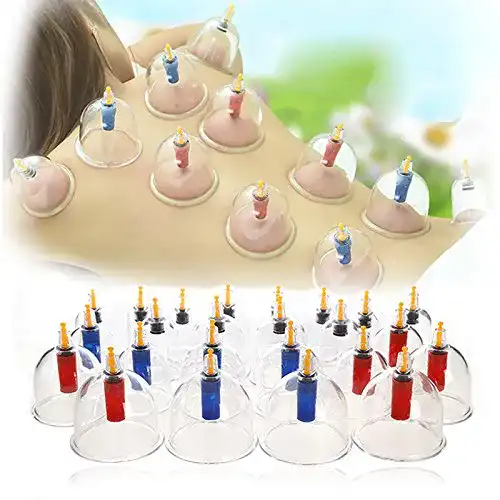 Schröpfglas Vendeur Pro Set mit 24 Schröpfgläsern für die Gesundheitspflege