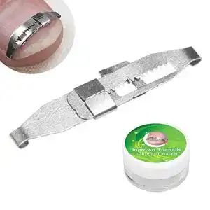 Yosoo Health Gear Nagelkorrekturspange für eingewachsene Zehennägel