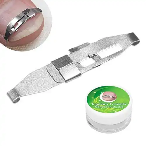 Nagelkorrekturspange Tmishion Set für eingewachsene Zehennägel