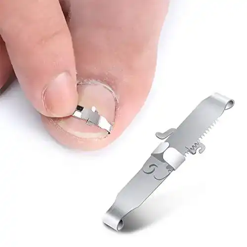 Nagelkorrekturspange Bezox 2 Stück für eingewachsene Zehennägel