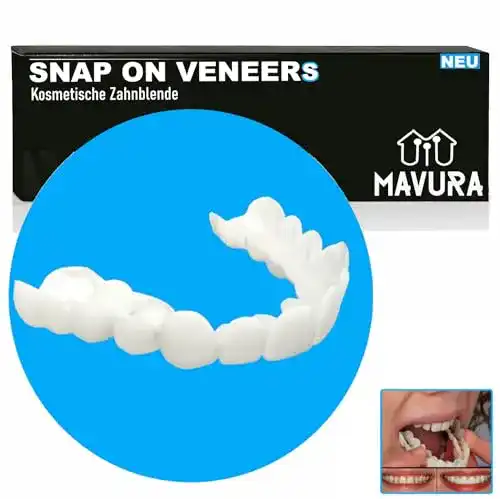 Zahnblende Mavura SnapOnVeneers Kosmetische Zahnprothese