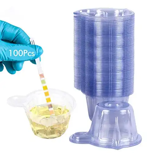 Urinbecher Wandefol 100 Stück 50ml Einweg-Urinprobenbecher